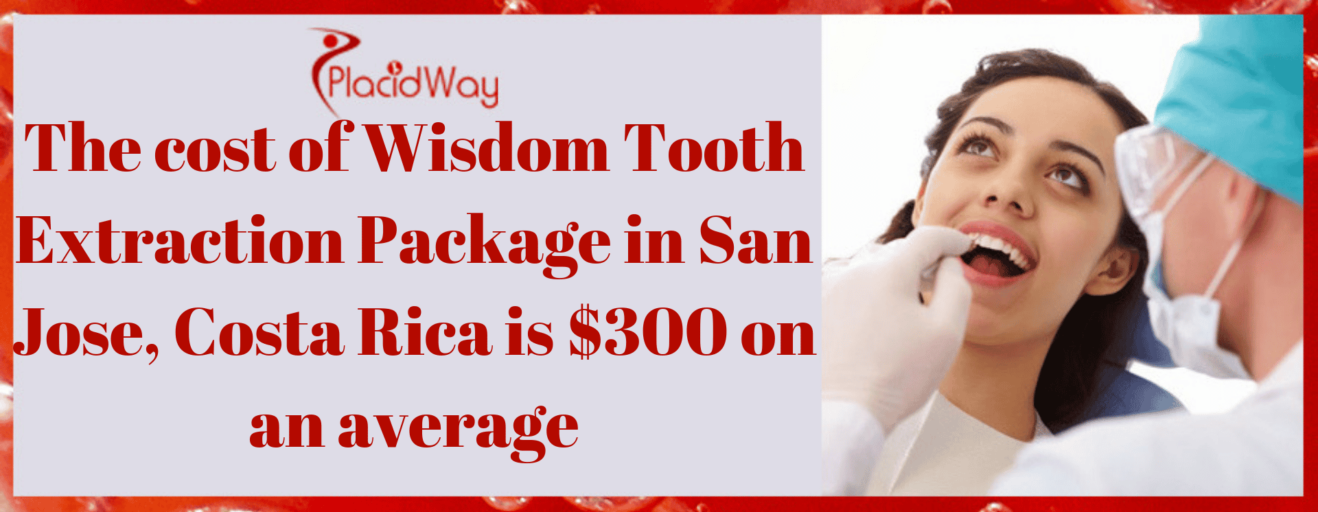 The cost of Wisdom Tooth Extraction Package in San Jose, Costa Rica is $300 on an average
